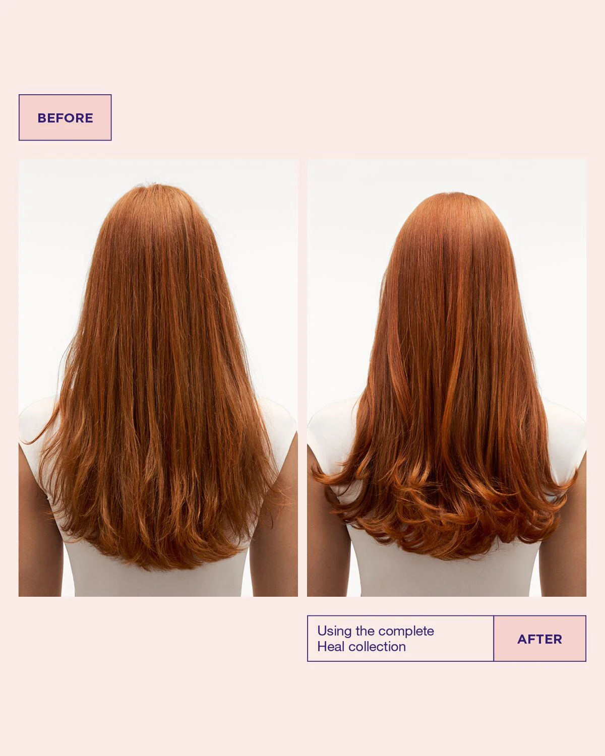 Head & Hair Heal Shampoo - Image 4